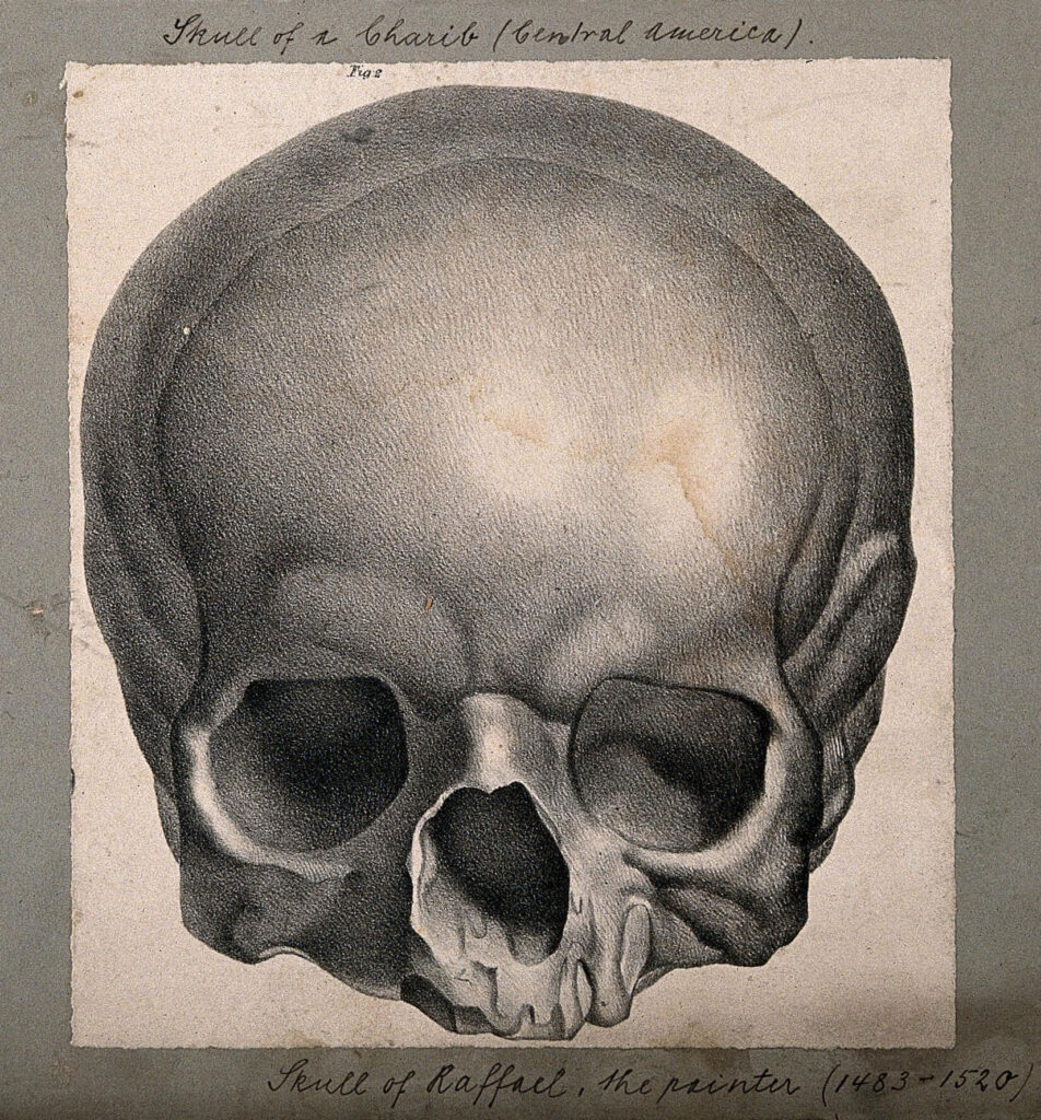 Bernard Hollander. Cráneo del pintor Rafael, principios del siglo XX. Wellcome Collection, Londres