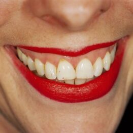 Martin Parr, lúdico y lúcido