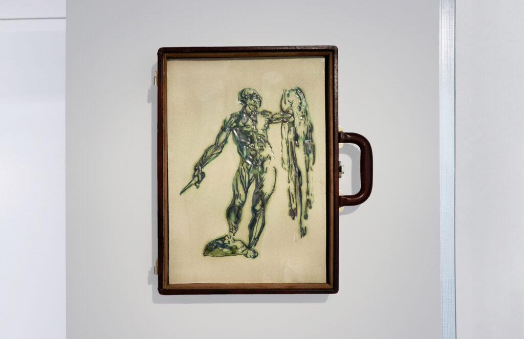 Lucas Marcos Barquilla. La planta del hipotálamo