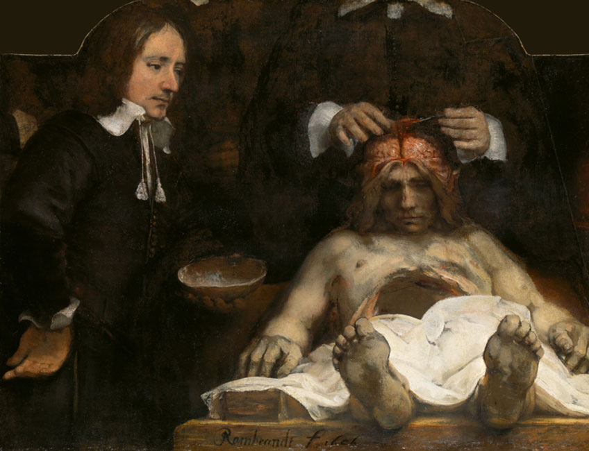 Rembrandt. La lección de anatomía del doctor Jan Deijman, 1656. Amsterdam Museum