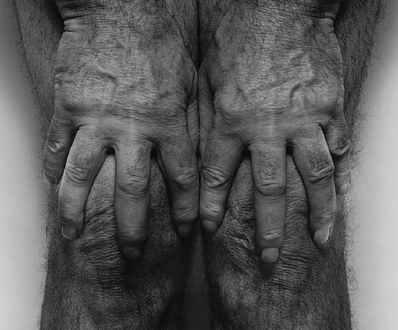 John Coplans. Self-Portrait (Hands Spread on Knees), 1985. Tate